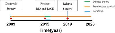 Case report and literature review: Isolated HCC- recurrence in gallbladder after curative resection
